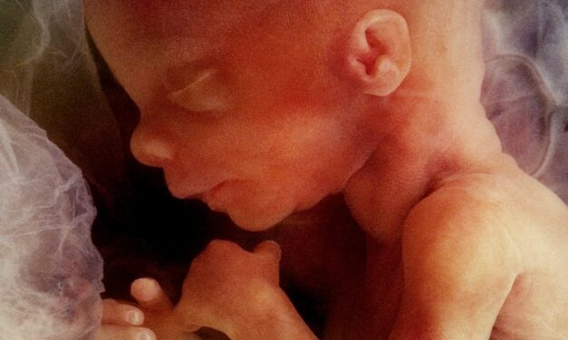 Pro-abortion folks cannot talk about the fetus