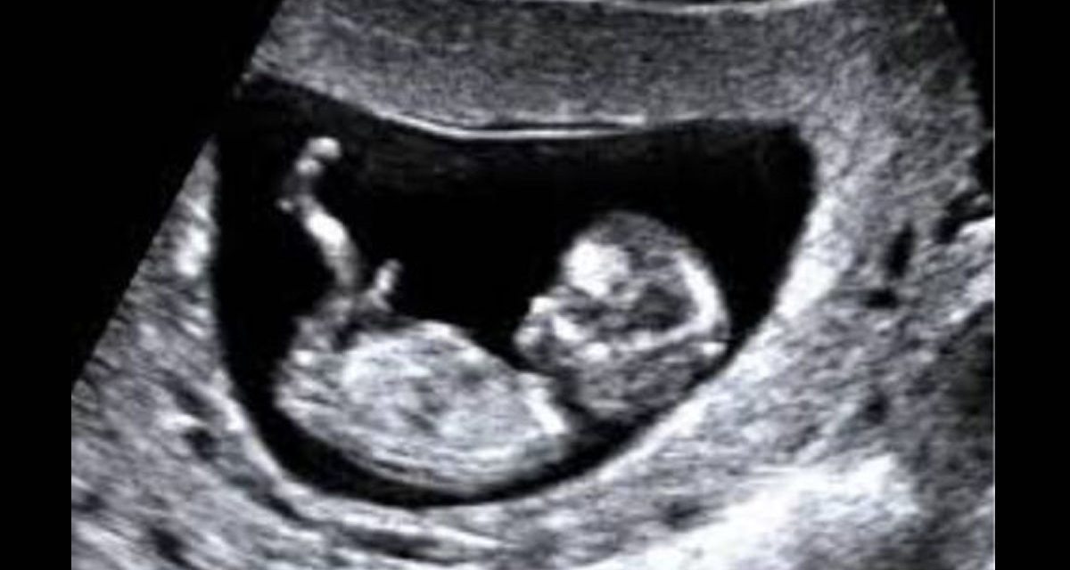 Planned Parenthood to Regain Federal Funding