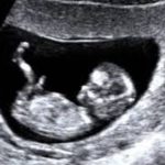 Planned Parenthood to Regain Federal Funding